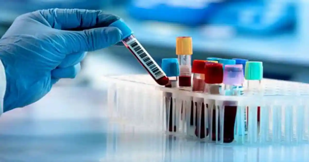 یونیورسٹی آف ہیلتھ سائنسز میں جدید کلینیکل لیبارٹری قائم